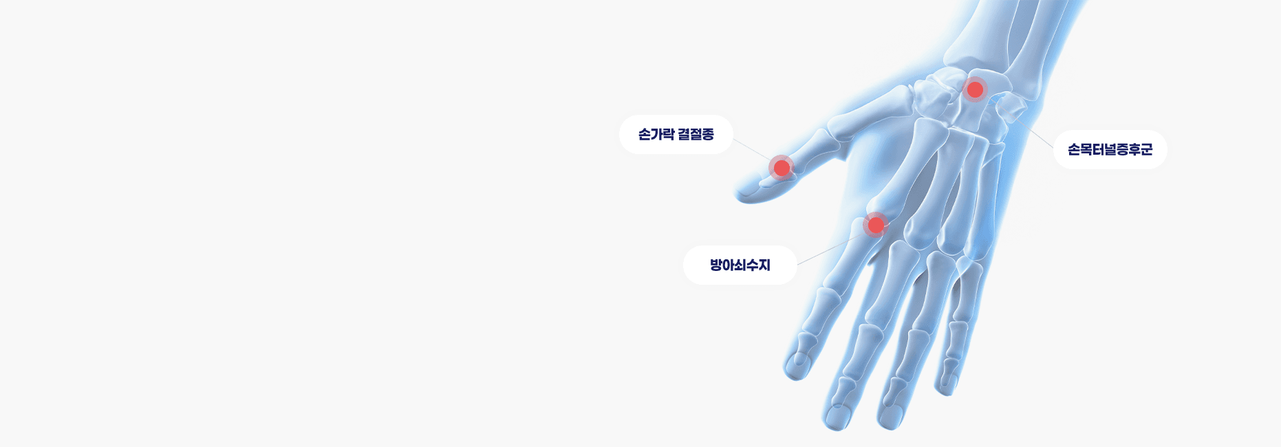 수부·족부클리닉